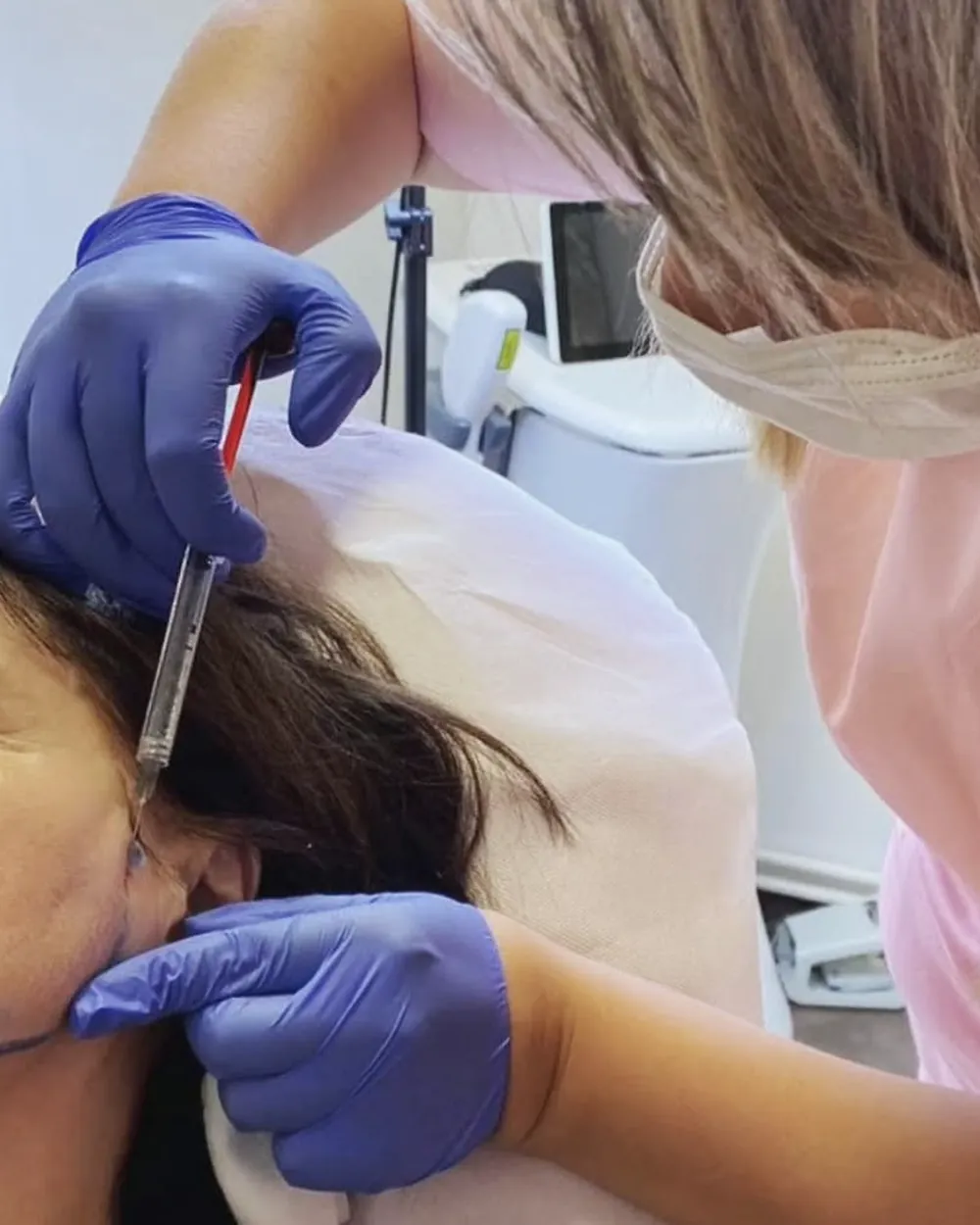 Mezoterapija i biorevitalizacija
